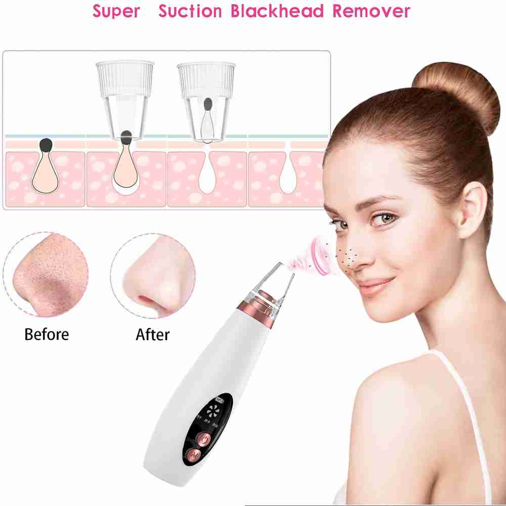 Limpiador Facial De Poros Y Puntos Negros Almalux® Multiklackcleaning