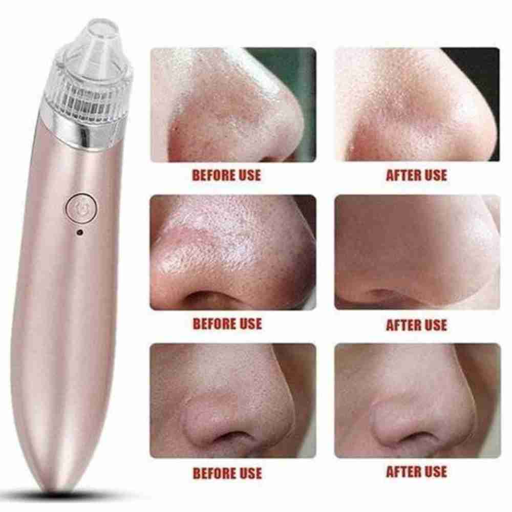 Limpiador De Puntos Negros Facial Almalux®