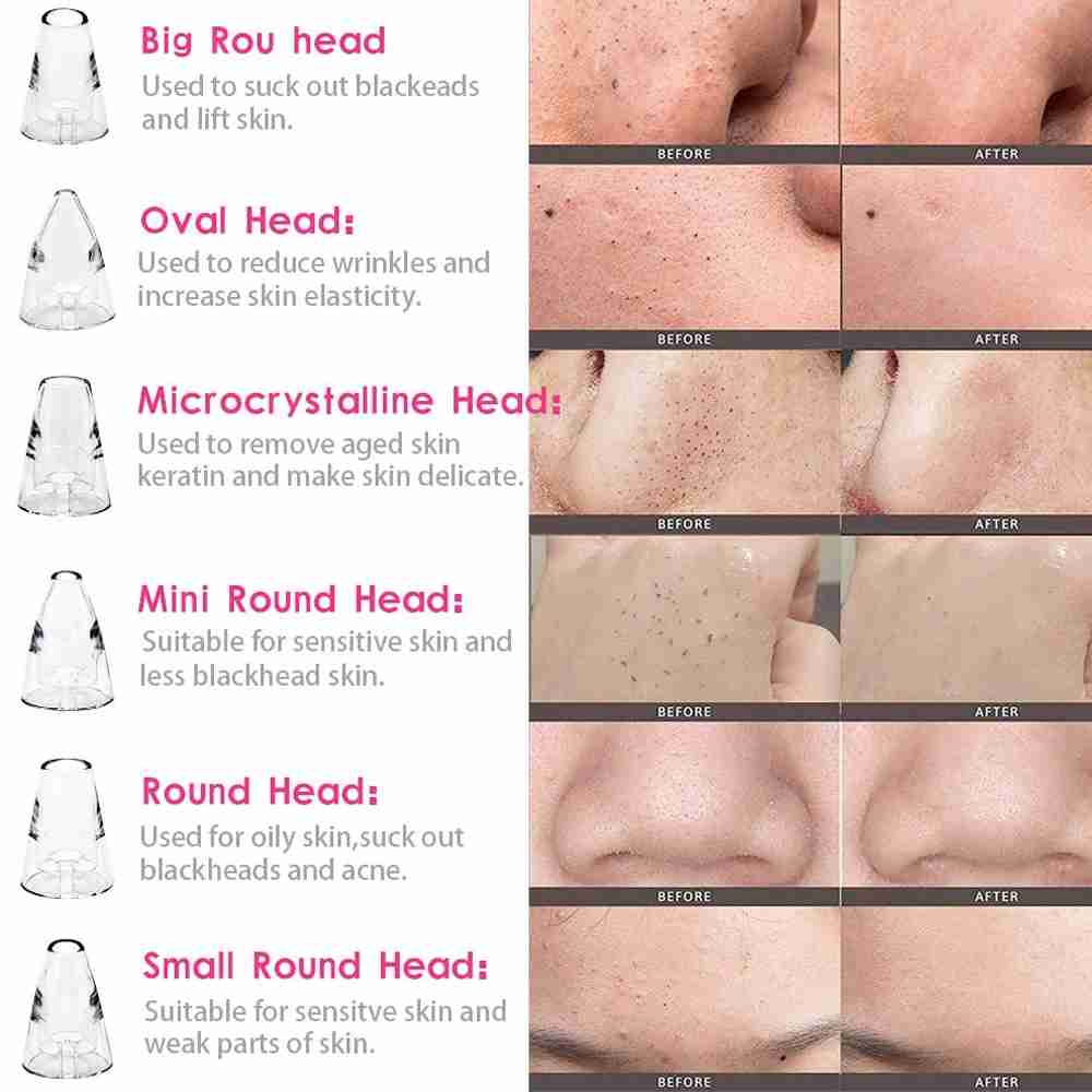 Limpiador Facial De Poros Y Puntos Negros Almalux® Multiklackcleaning