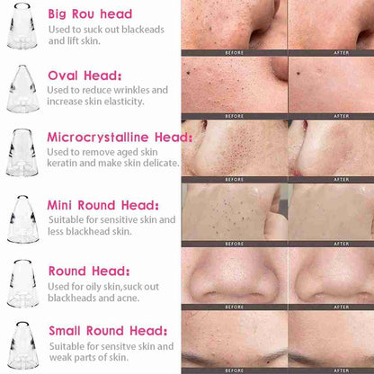 Limpiador Facial De Poros Y Puntos Negros Almalux® Multiklackcleaning